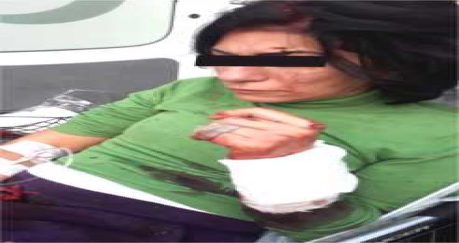 DATÇA ' DA SEVGİLİSİYLE TARTIŞAN KADIN BİLEĞİNİ KESTİ